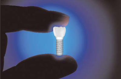 Implantology